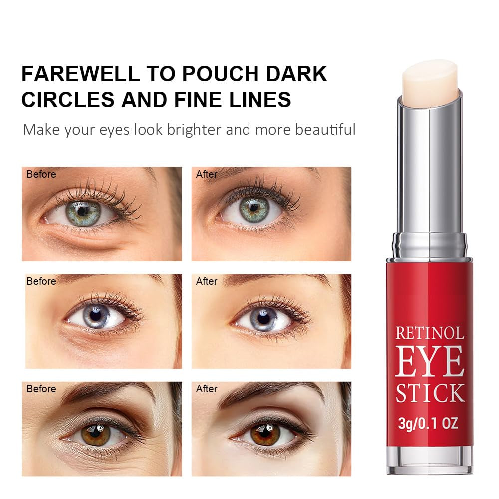 Retinol Eye Stick, Retinol Eye Cream with Collagen,Hyaluronic Acid for Dark Circle, Wrinkles, under Eyecream anti Aging, Reduces Puffiness Fine Lines, Visible Results in 3-4 Weeks